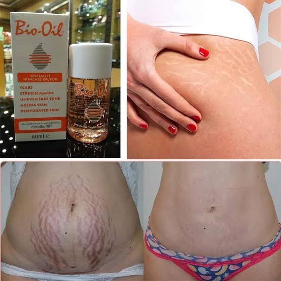 Picture of 60 ml Bio-Oil specialist skin care PurCellin oil International South