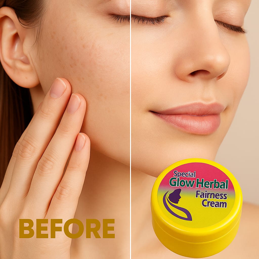 Picture of Glow Herbal Fairness Cream