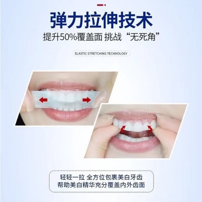 Picture of Professional At-Home Teeth Whitening Kit
