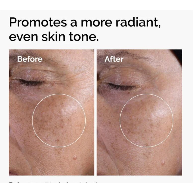 Picture of The Ordinary Glycolic Acid 7% Exfoliating Toner - 240 ML