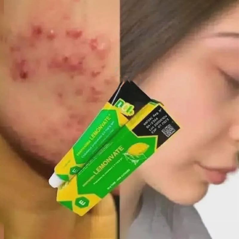 Picture of Esapharma Lemonvate Cream 30g - lemonvate dark spot remover gel