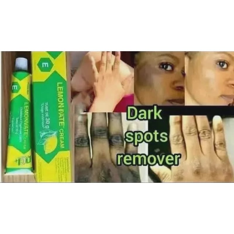 Picture of Esapharma Lemonvate Cream 30g - lemonvate dark spot remover gel