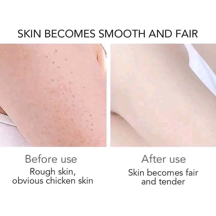 Picture of Skino Strawberry Flavoured Shower Gel for Soft & Glowing Skin - 220ml - Fruity