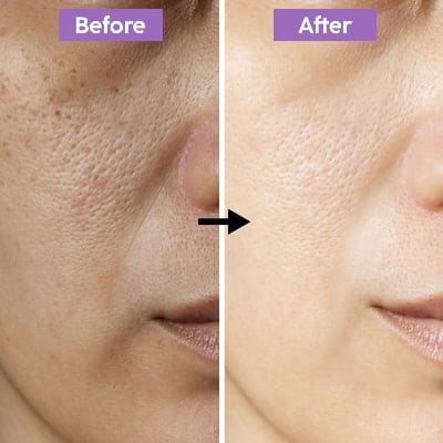 Picture of Gluta Collagen Pink Full Face & Body Whitening Combo Set