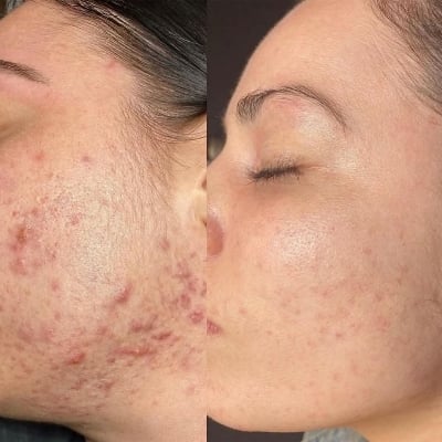 Picture of Dr. Althea 345 Relief Cream 50ml (Korea)
