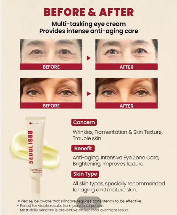 Picture of KSECRET SEOUL 1988 EYE CREAM : RETINAL LIPOSOME 4% + FERMENTED BEAN 30ML