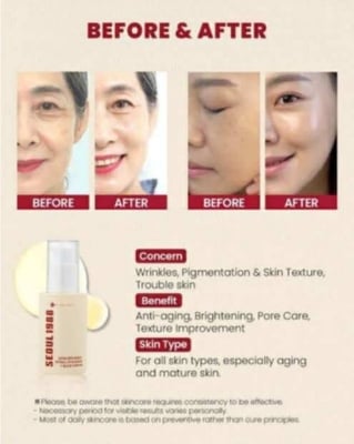 Picture of K-SECRET SEOUL 1988 Retinal Liposome 2% + Black Ginseng Serum - সতেজ