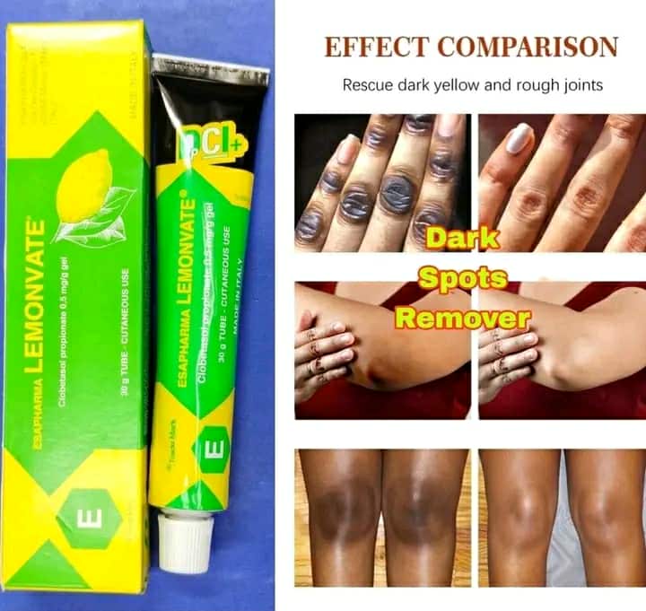 Picture of Lemonvate Spot Removing Whitening Cream - 30gm