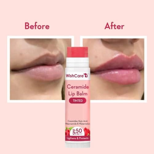 Picture of WishCare Ceramide Lip Balm Tinted/Natural With SPF 50 PA+++ 5gm