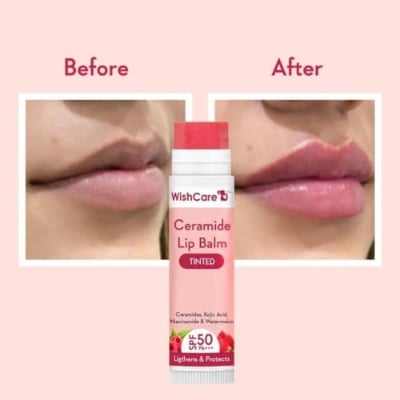 Picture of WishCare Ceramide Lip Balm Tinted/Natural With SPF 50 PA+++ 5gm
