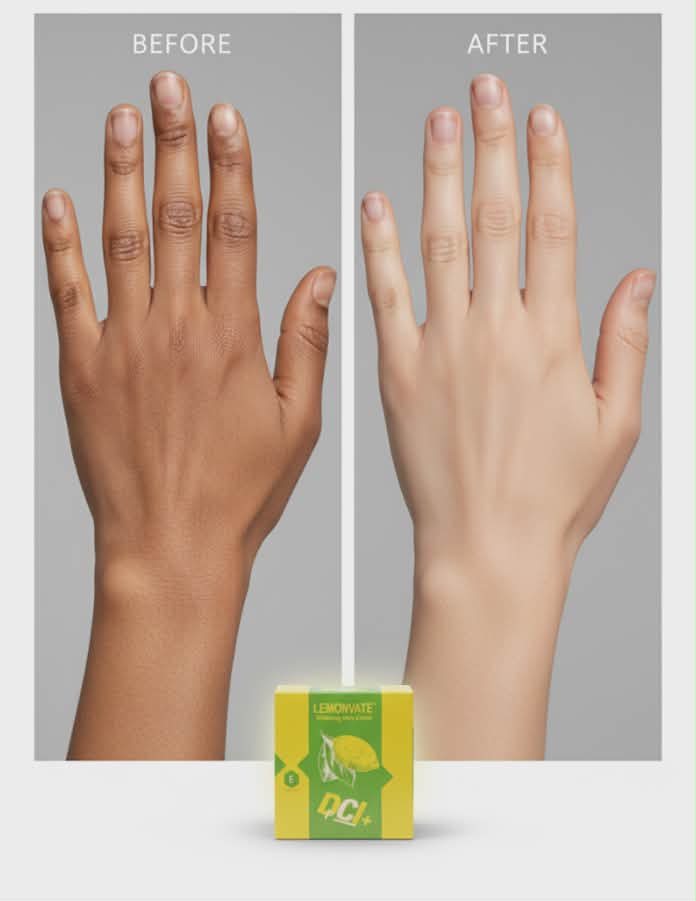 Picture of Lemonvate Whitening Body Cream - 300gm - Fresh