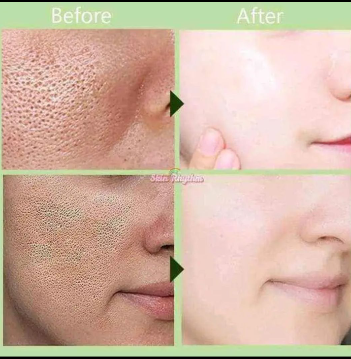 Picture of Celebrity Glow Skin Glutathione Super Whitening Combo Set (Soap,Day Cream,night cream)