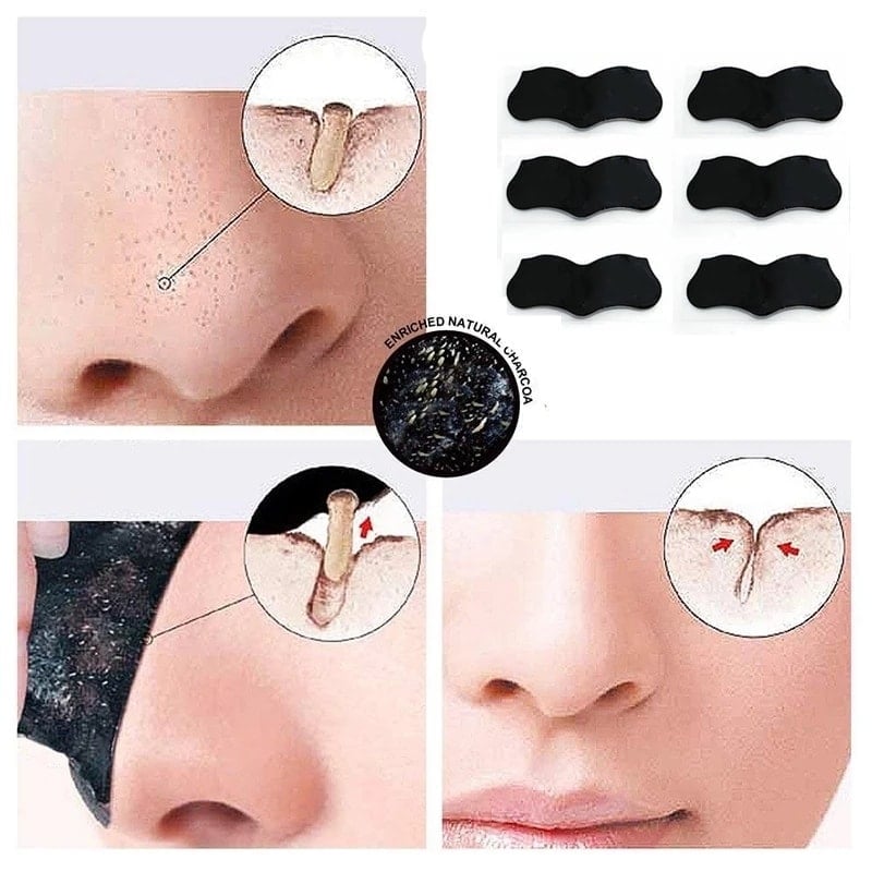 Picture of Blackhead Remover[1Pcs]