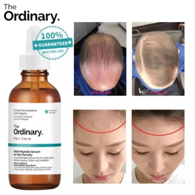 Picture of MultiPeptide Serum Hair Density 60ml