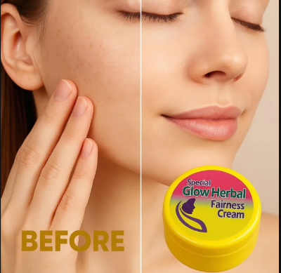Picture of Glow Harbal Fairness Cream