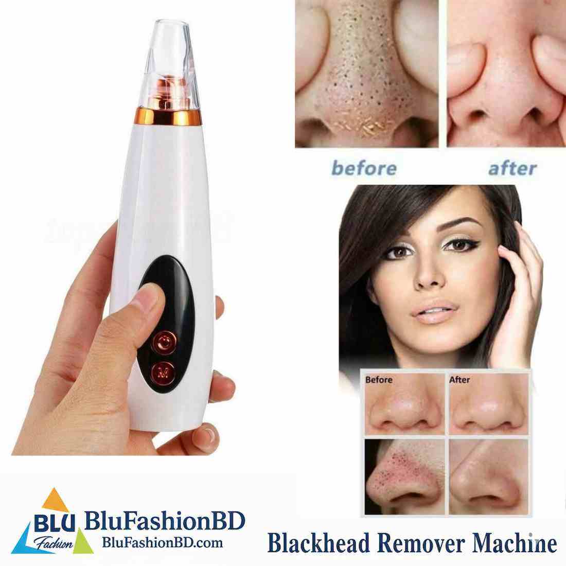 Picture of Blackhead Remover