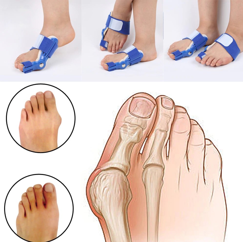 Picture of Bunion Hallux Valgus Orthopedic Braces Toe Correction Night Foot Care Corrector Thumb Daily Big Bone Tools