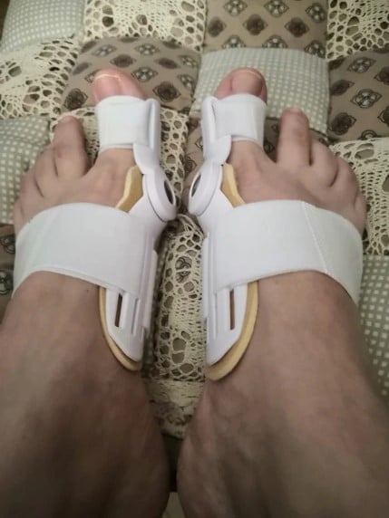 Picture of 1pc Big Toe Separator Foot Care Tool Separators Stretchers Foot Pads Adjustable Hallux Valgus Orthopedic insoles Pain Relief