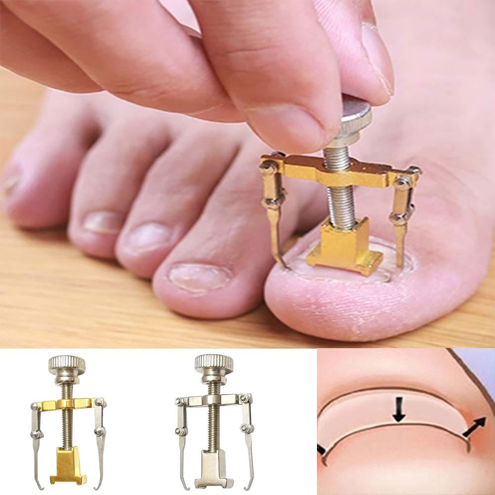 Picture of Ingrown Toenail Toe Fixer Recover Correction Device Pedicure Foot Nail Care Tool
