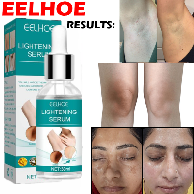 Picture of Dark Parts Dark Underarm and Bikini Areas Whitening Anti Wrinkle Moisturizing Makes Your Private area Clean And White