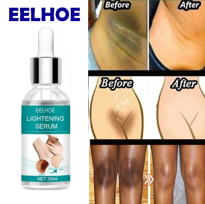 Picture of Dark Parts Dark Underarm and Bikini Areas Whitening Anti Wrinkle Moisturizing Makes Your Private area Clean And White