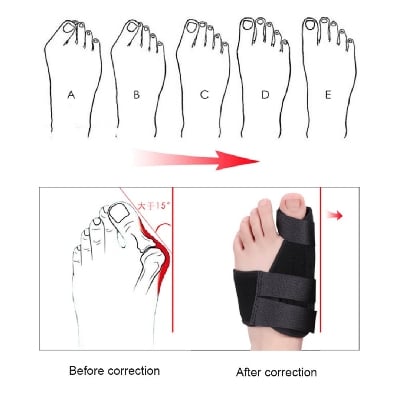 Picture of Bunion Corrector for Women & Men Big Toe, Bunion Relief Toe Straightener Bunion Splint Anti-Slip Heel Strap Comfortable Breathable for Day and Night