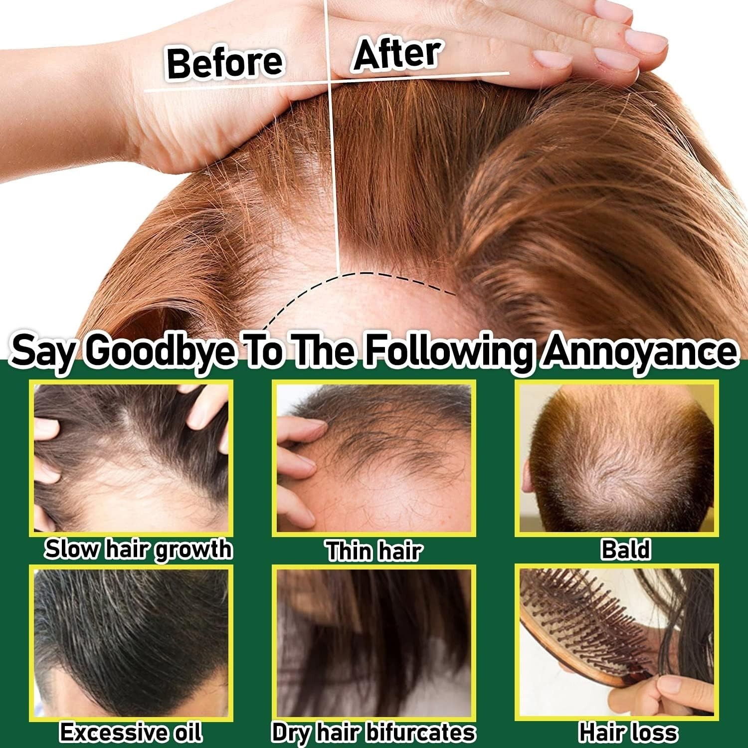 Picture of Natural Regrowth Hair Oil Wild Hair loss Care Product For Man Women Ginger Organic Hair Growth Oil Ginger oil-Multicolor