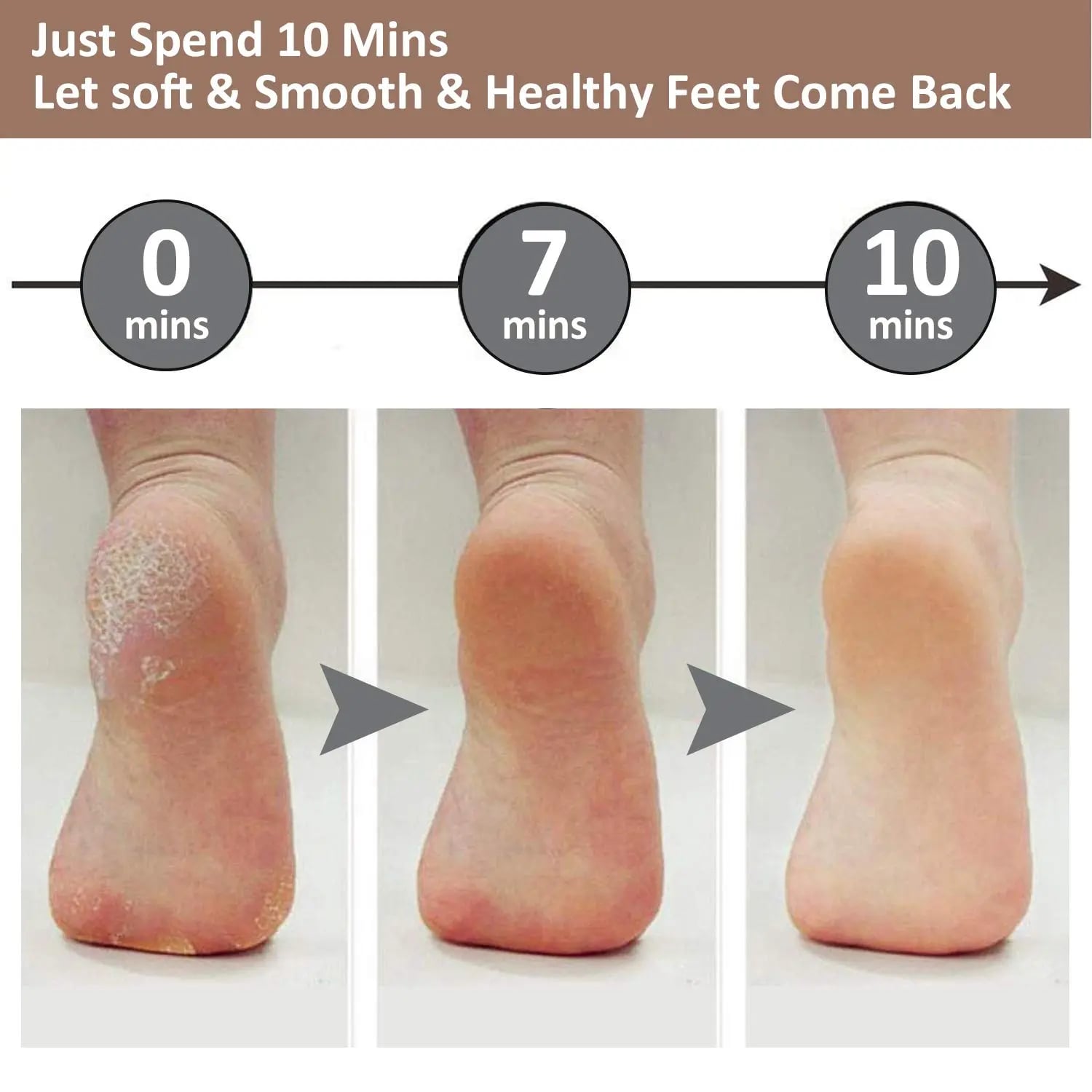Picture of Electric Foot Callus Removers Rechargeable pedi spin, Portable Electronic Foot File Pedicure Tools-Multicolor