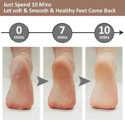 Picture of Electric Foot Callus Removers Rechargeable pedi spin, Portable Electronic Foot File Pedicure Tools-Multicolor
