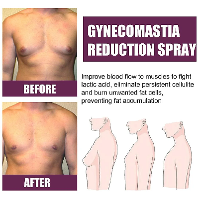 Picture of South Moon Gynecomastia Firming Spray Cellulite Reduction Muscle Accelerating Hardening Spray Tighten Chest Muscle Fitness- 30ml-Gynecomastia Spray