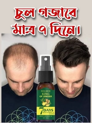 Picture of 7 Day Ginger Hair Growth Essence Germinal Serum Essence Oil Natural Hair Loss Treatement Effective Fast Growth Hair Care -50ML-Multicolor, Random Color