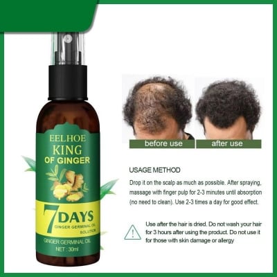Picture of 7 Day Ginger Hair Growth Essence Germinal Serum Essence Oil Natural Hair Loss Treatement Effective Fast Growth Hair Care -50ML-Multicolor, Random Color