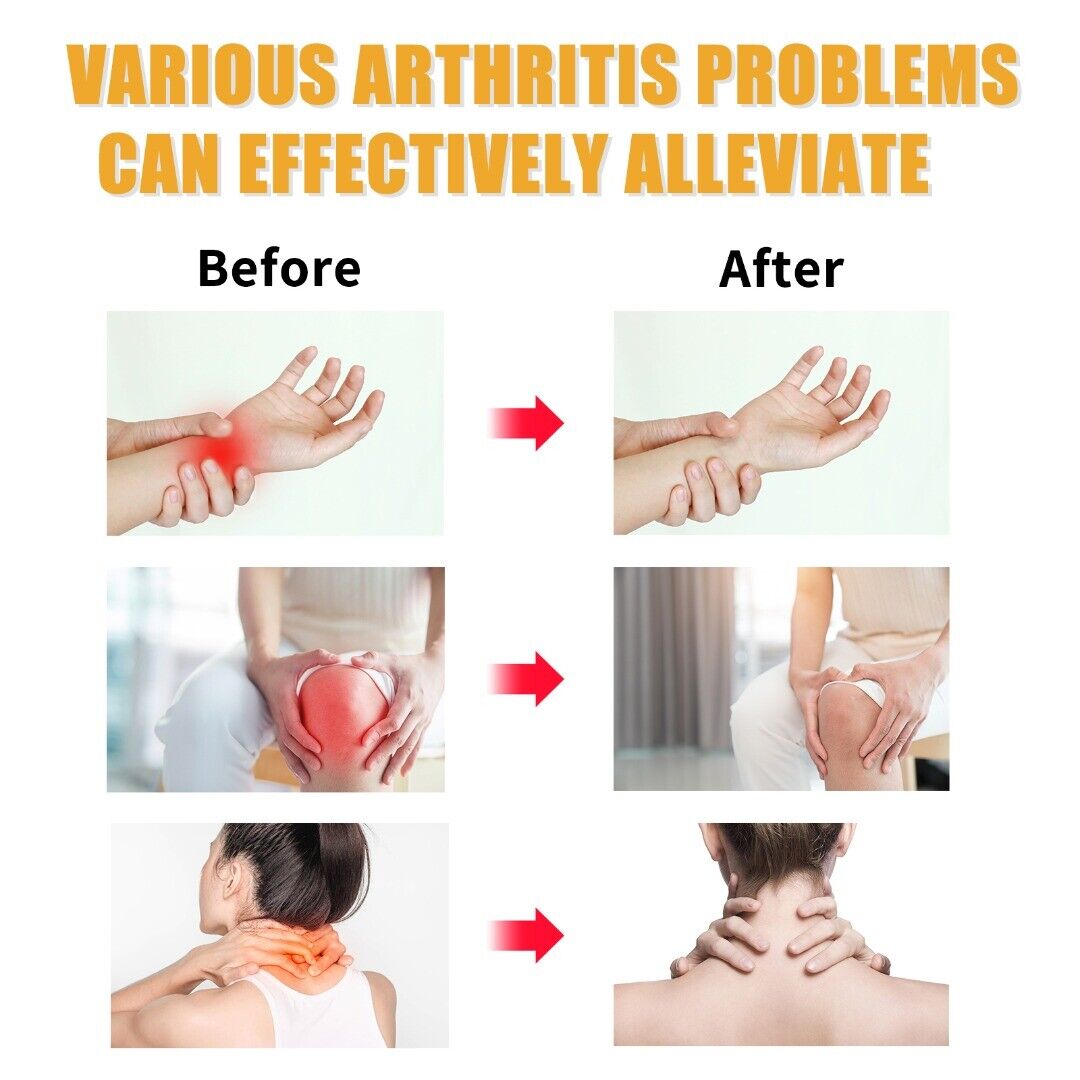 Picture of Joint Pain Relief Cream For Artharities-Multicolor