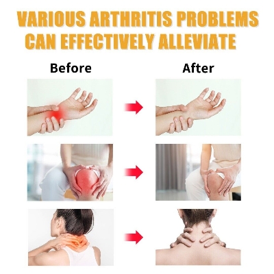 Picture of Joint Pain Relief Cream For Artharities-Multicolor