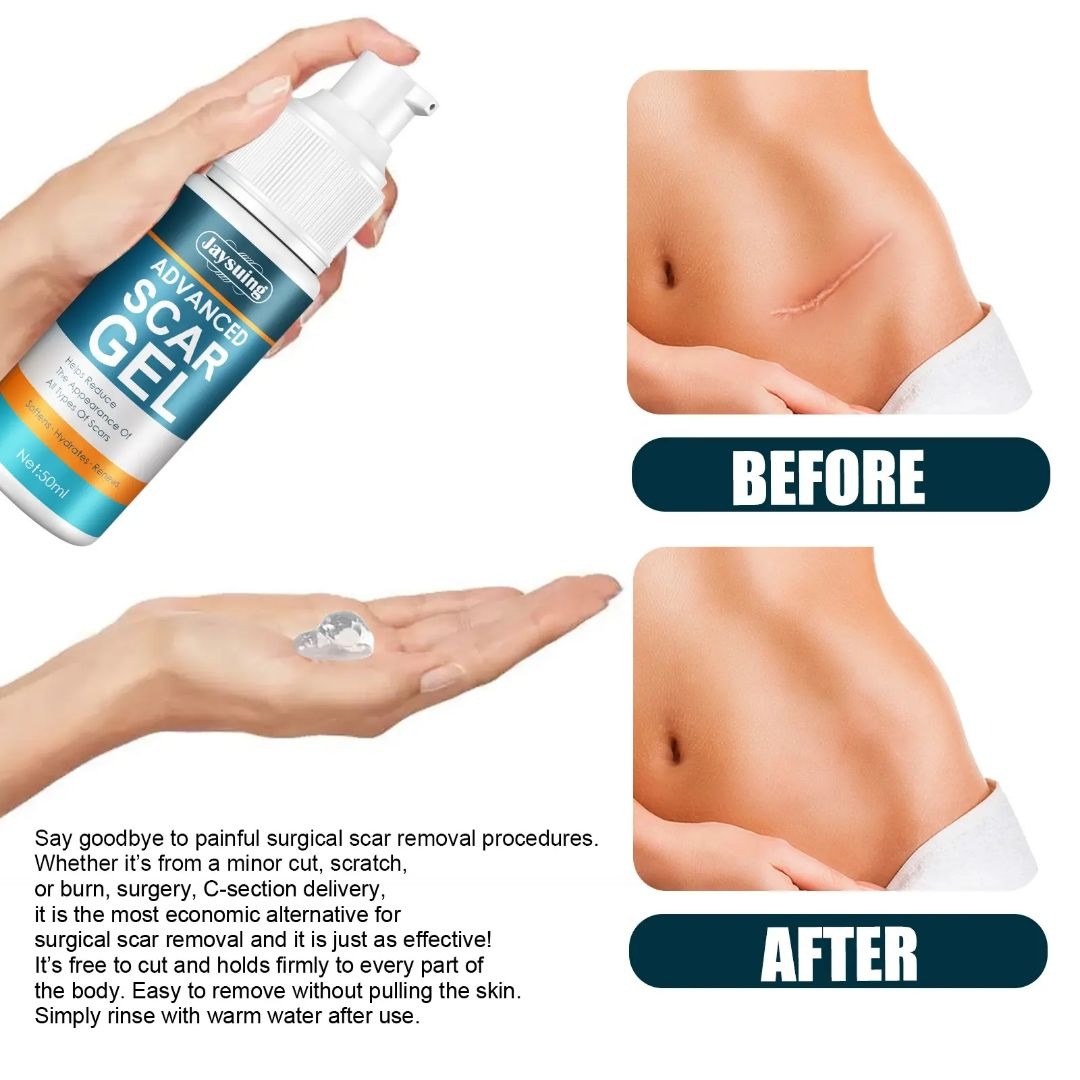 Picture of Advanced Scar Gel, Silicone Scar Gel, Treats Old and New Scars, Reduces the Appearance of Scars from, Body, Face, Stretch Marks, Surgical Scar-Scar Removal Gel