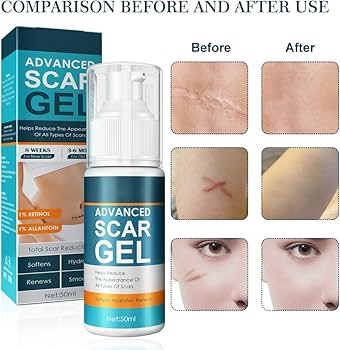 Picture of Advanced Scar Gel, Silicone Scar Gel, Treats Old and New Scars, Reduces the Appearance of Scars from, Body, Face, Stretch Marks, Surgical Scar-Scar Removal Gel