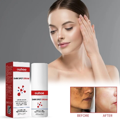 Picture of Dark Spot Remover For Face & Body Age Spot Brown Spot Sun Spot & Freckle Remover Cream spary- Multicolor