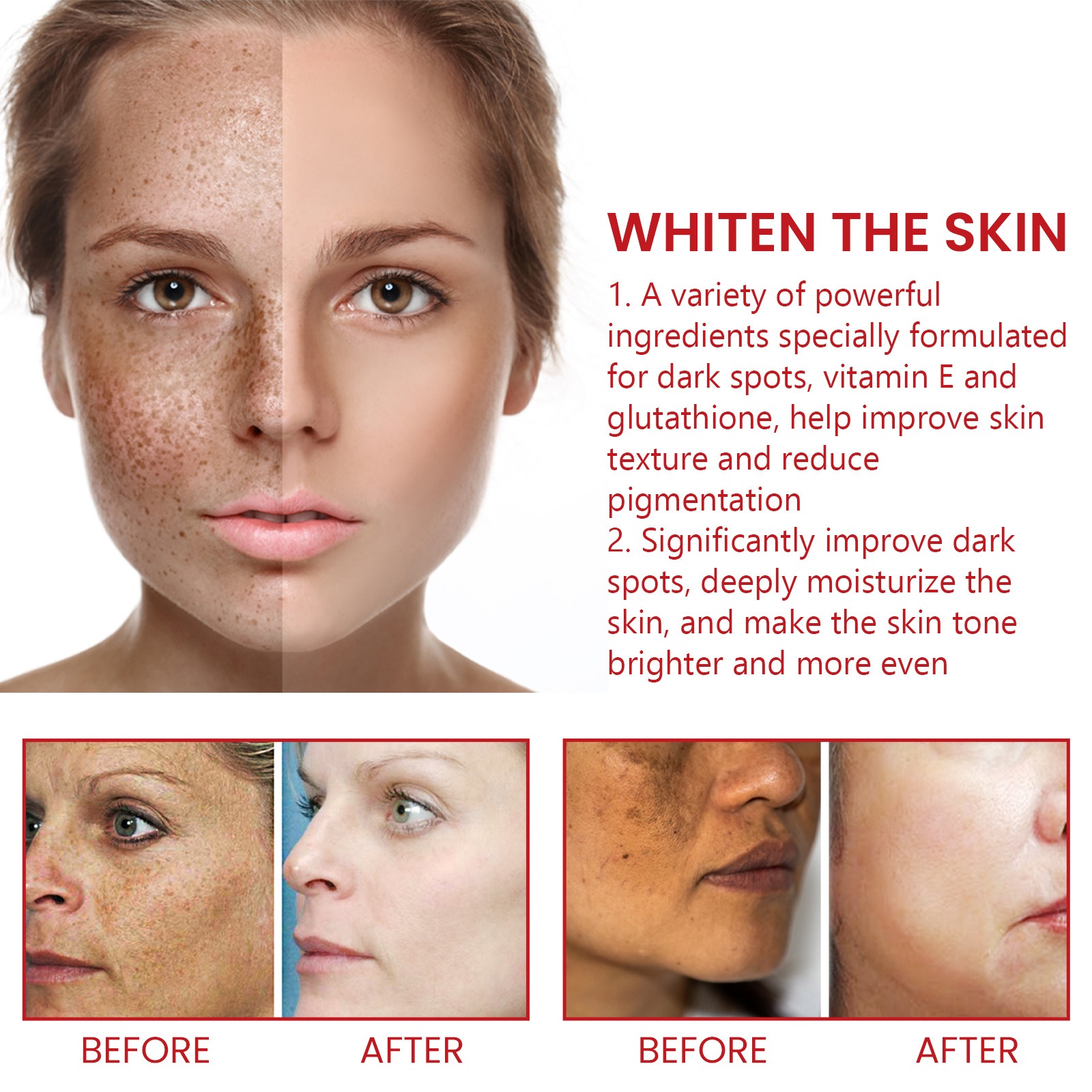 Picture of Dark Spot Remover For Face & Body Age Spot Brown Spot Sun Spot & Freckle Remover Cream spary- Multicolor