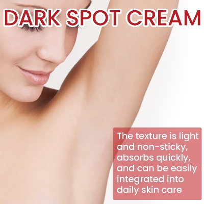 Picture of Dark Spot Remover For Face & Body Age Spot Brown Spot Sun Spot & Freckle Remover Cream spary- Multicolor