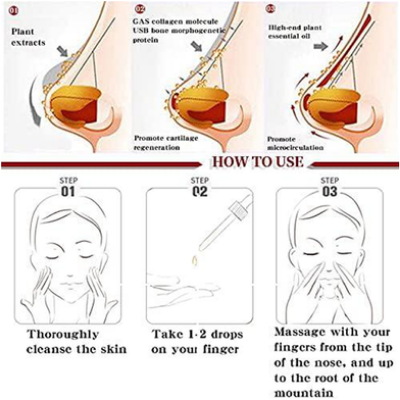 Picture of ROEDAX Beautiful Nose Essential Oil- Rhinoplasty Heightening Nasal Bone Straightening Nose Firming and Lifting Nose Bridge Nasal Bone Remodeling Massage Essence 30ml- Multicolor