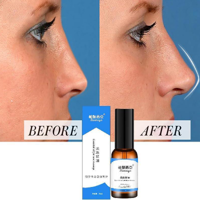 Picture of ROEDAX Beautiful Nose Essential Oil- Rhinoplasty Heightening Nasal Bone Straightening Nose Firming and Lifting Nose Bridge Nasal Bone Remodeling Massage Essence 30ml- Multicolor
