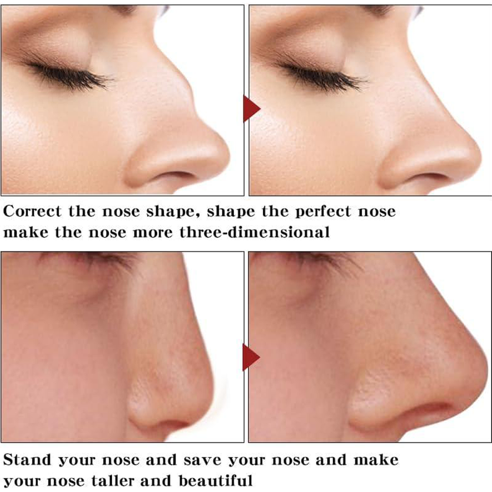 Picture of ROEDAX Beautiful Nose Essential Oil- Rhinoplasty Heightening Nasal Bone Straightening Nose Firming and Lifting Nose Bridge Nasal Bone Remodeling Massage Essence 30ml- Multicolor