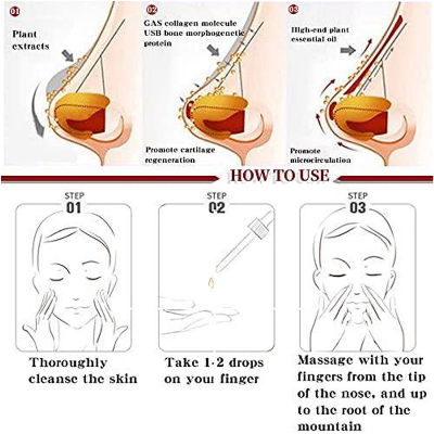Picture of ROEDAX Beautiful Nose Essential Oil- Rhinoplasty Heightening Nasal Bone Straightening Nose Firming and Lifting Nose Bridge Nasal Bone Remodeling Massage Essence 30ml- Multicolor