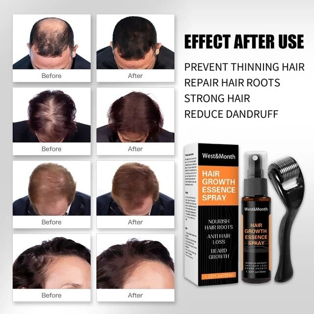 Picture of West & Month Hair Growth Essence Spray Hair Loss Product Hair Regrowth Spray Anti Preventing Hair Loss- Multicolor