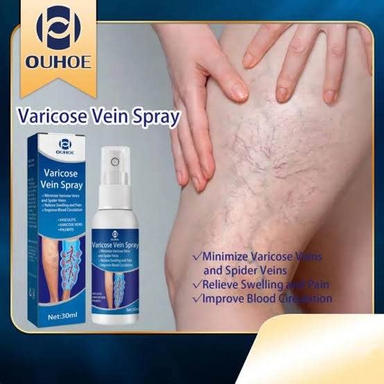 Picture of Varicose Veins Spray Medicine Spider Veins Relief Plaster Care-Multicolor
