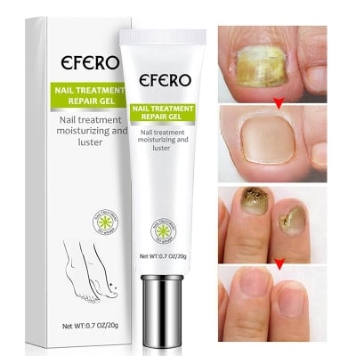 Picture of Efero Nail Repair Nail Care Helps Improve Discolored, Cracked & Thickened Toenails & Fingernails | Supports Healthy Nail Renewal Cream-20gm-Multicolor