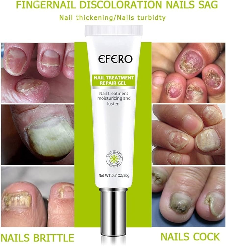 Picture of Efero Nail Repair Nail Care Helps Improve Discolored, Cracked & Thickened Toenails & Fingernails | Supports Healthy Nail Renewal Cream-20gm-Multicolor