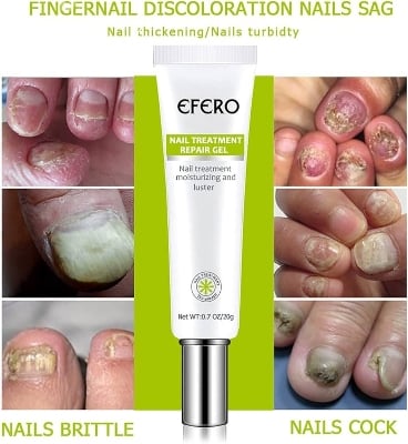 Picture of Efero Nail Repair Nail Care Helps Improve Discolored, Cracked & Thickened Toenails & Fingernails | Supports Healthy Nail Renewal Cream-20gm-Multicolor