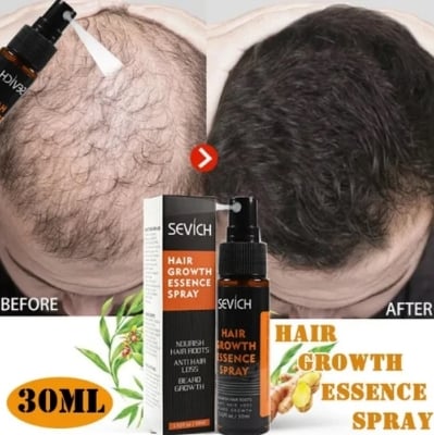 Picture of SEVICH Hair Growth Essence Spray - Natural Fragrance Free Hair Care for Men and Women, 30ml, Hair Loss & Thinning Prevention Treatment, Scalp Improver, Biotin for Healthy Hair-Multicolor