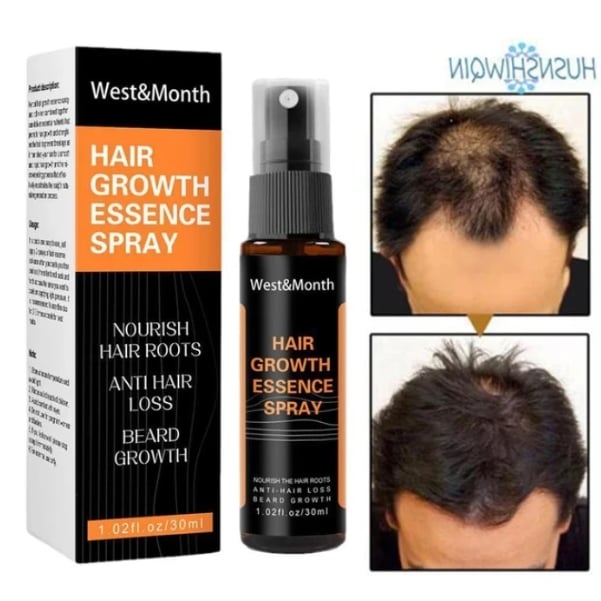Picture of SEVICH Hair Growth Essence Spray - Natural Fragrance Free Hair Care for Men and Women, 30ml, Hair Loss & Thinning Prevention Treatment, Scalp Improver, Biotin for Healthy Hair-Multicolor